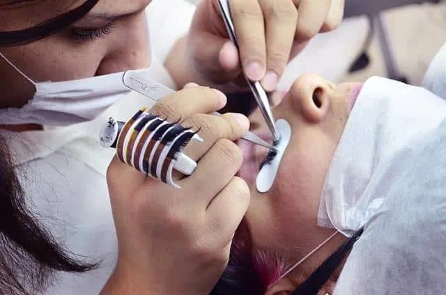 Epilation au laser